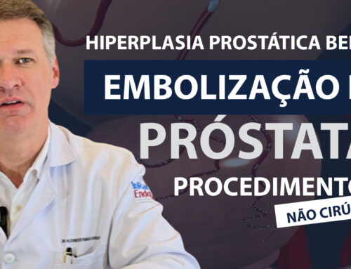 Embolização de Próstata – Hiperplasia Prostática Benigna – Dr. Alexander Corvello